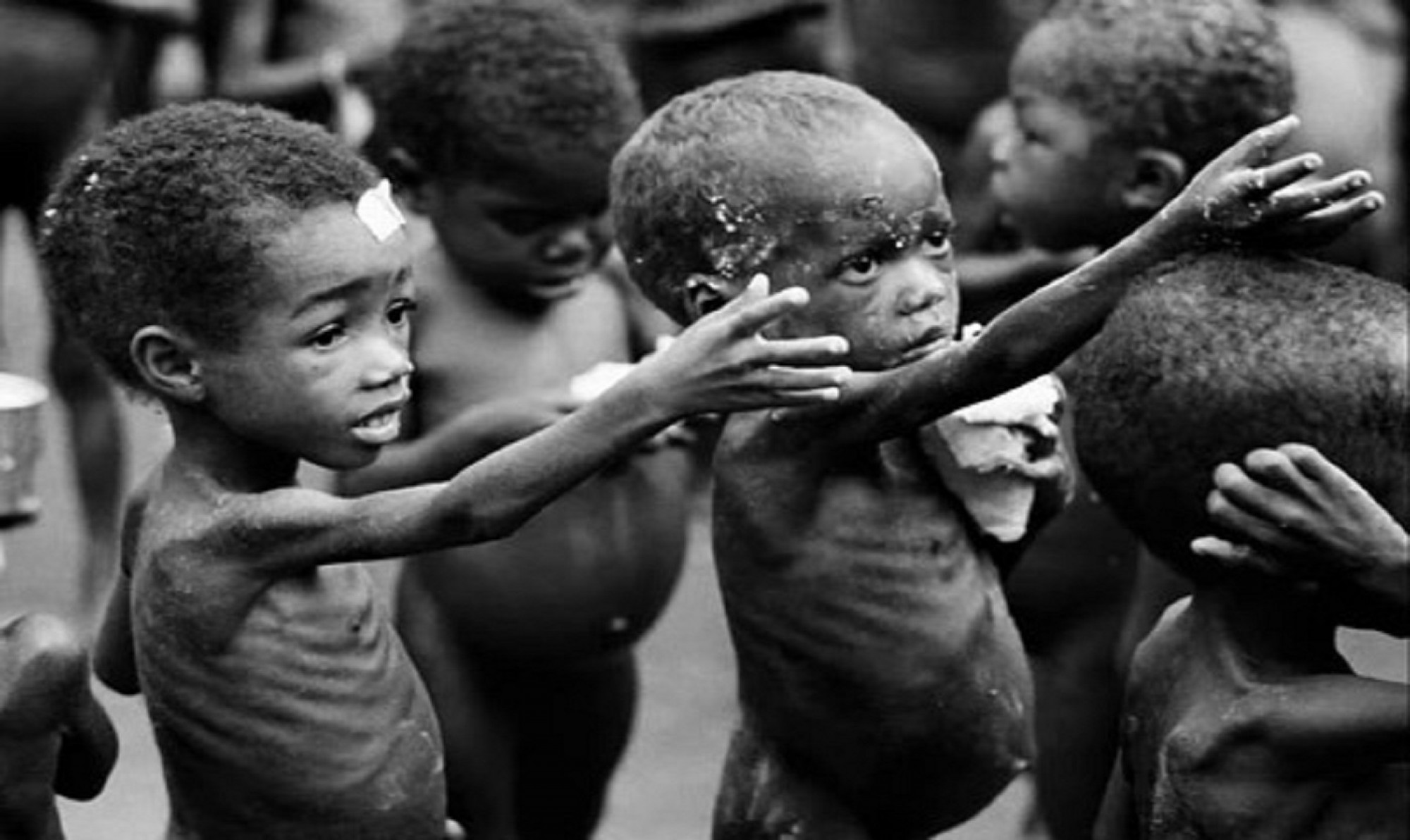 Nutrición, hambre, alimentos, desnutrición